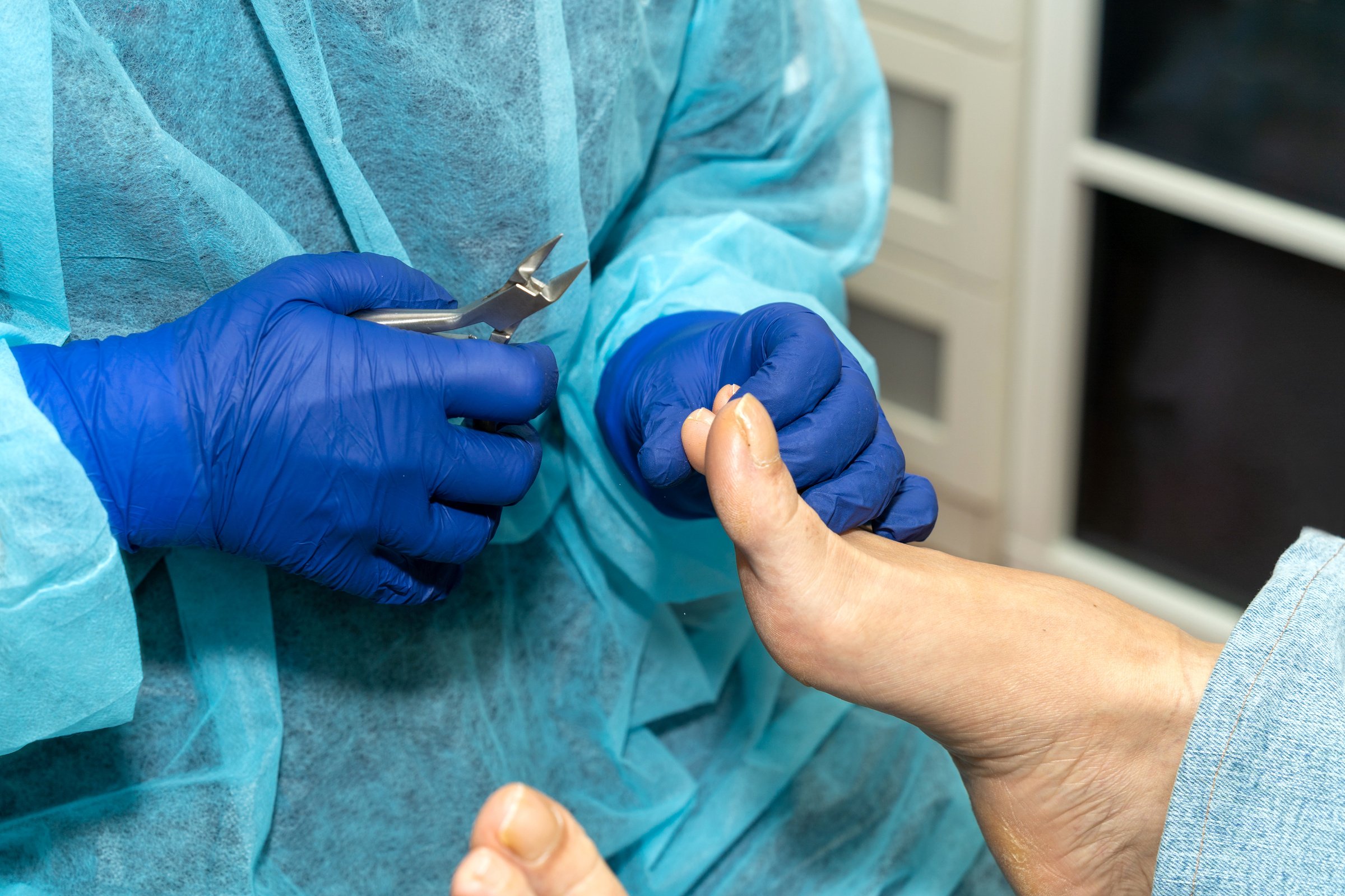 Patient relaxes as podiatrist cuts toenails with nail clippers. Wellness for the feet